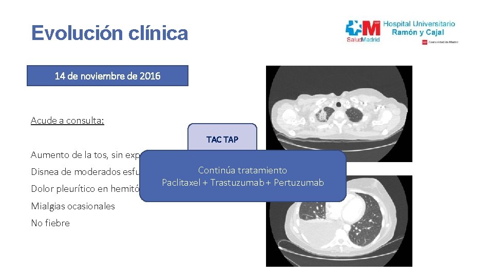 Evolución clínica 14 de noviembre de 2016 Acude a consulta: TAC TAP Aumento de