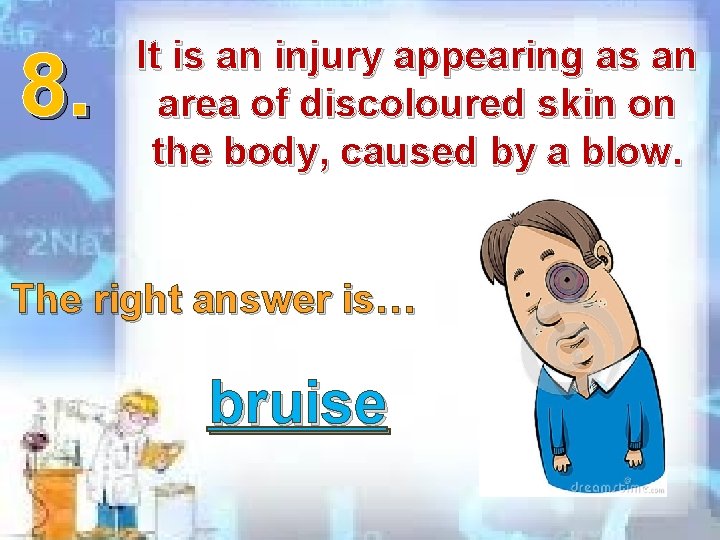 8. It is an injury appearing as an area of discoloured skin on the 8. It is an injury appearing as an area of discoloured skin on the