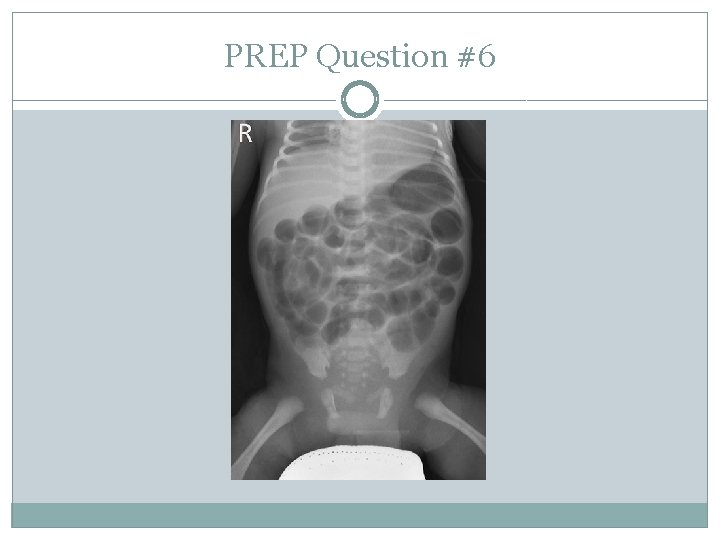 PREP Question #6 