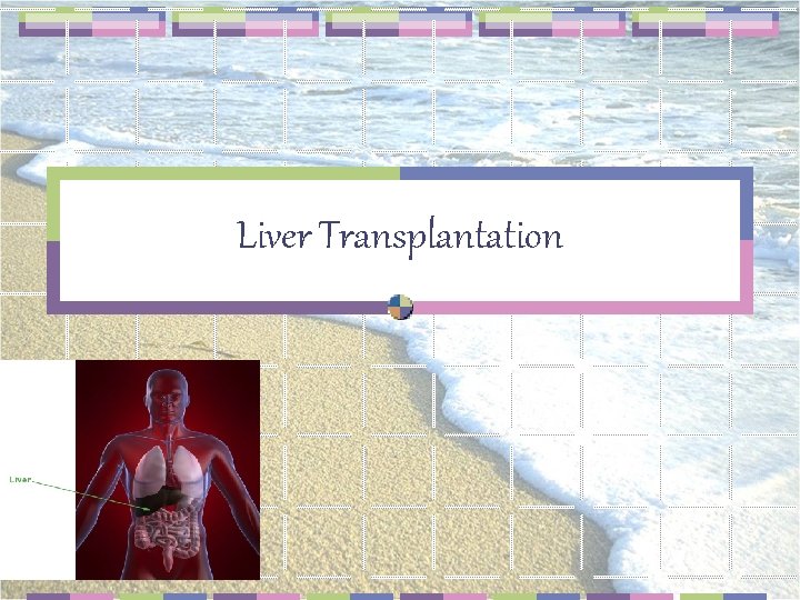 Liver Transplantation 