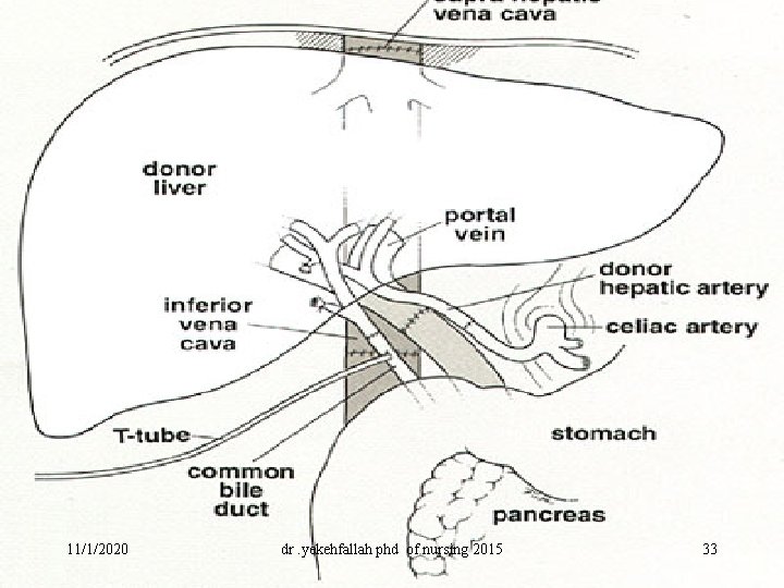 11/1/2020 dr. yekehfallah phd of nursing 2015 33 