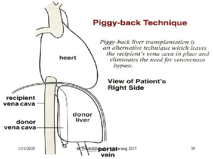 11/1/2020 dr. yekehfallah phd of nursing 2015 39 