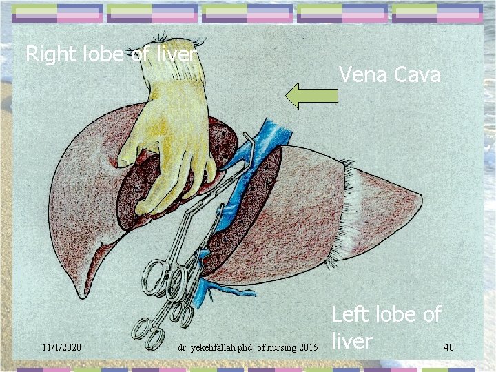  Right lobe of liver Vena Cava Left lobe of 11/1/2020 dr. yekehfallah phd