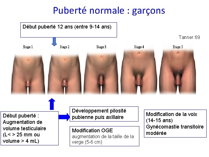 Puberté normale : garçons Début puberté 12 ans (entre 9 -14 ans) Tanner 69