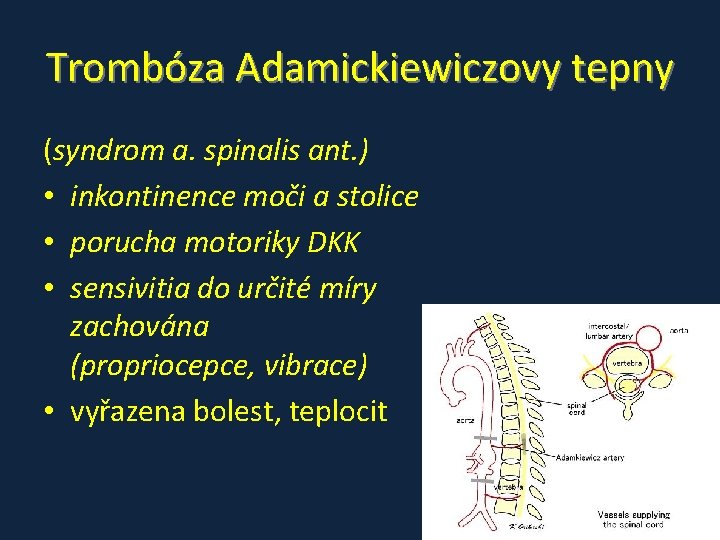 Trombóza Adamickiewiczovy tepny (syndrom a. spinalis ant. ) • inkontinence moči a stolice • Trombóza Adamickiewiczovy tepny (syndrom a. spinalis ant. ) • inkontinence moči a stolice •