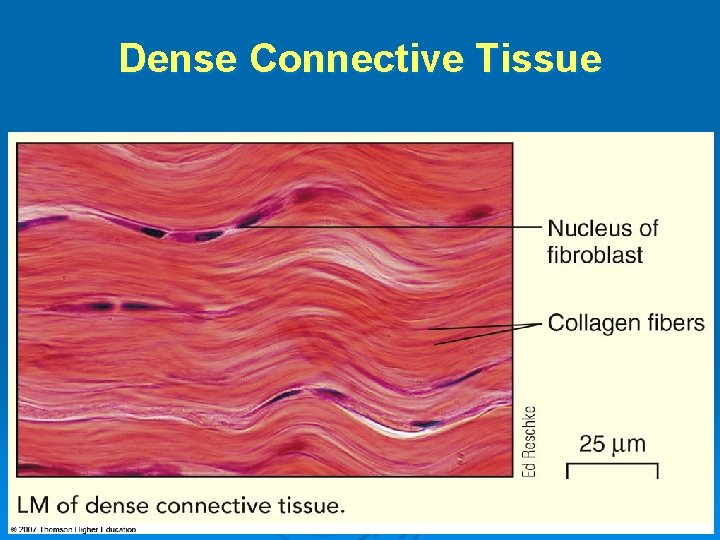 Dense Connective Tissue 