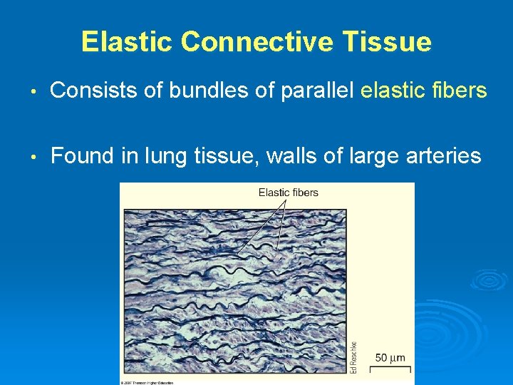 Elastic Connective Tissue • Consists of bundles of parallel elastic fibers • Found in