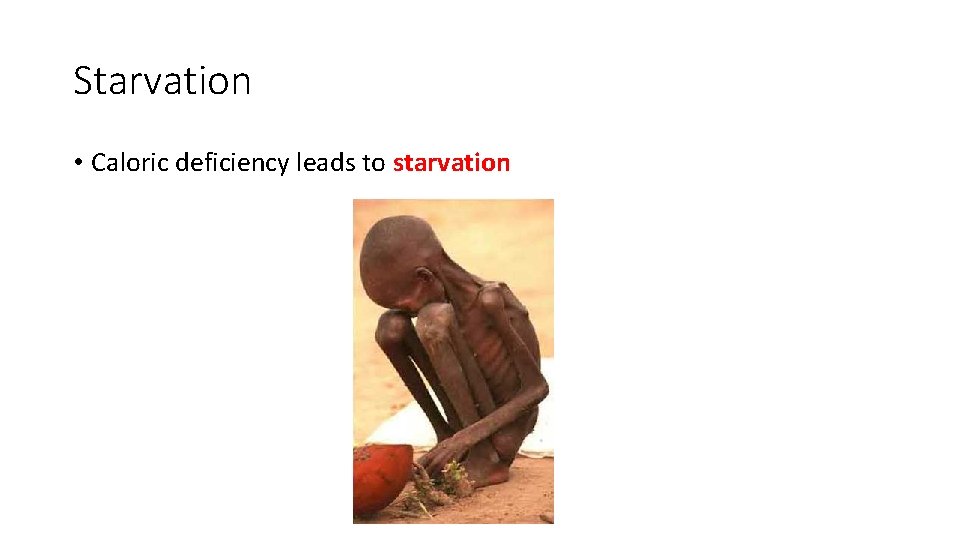 Starvation • Caloric deficiency leads to starvation 