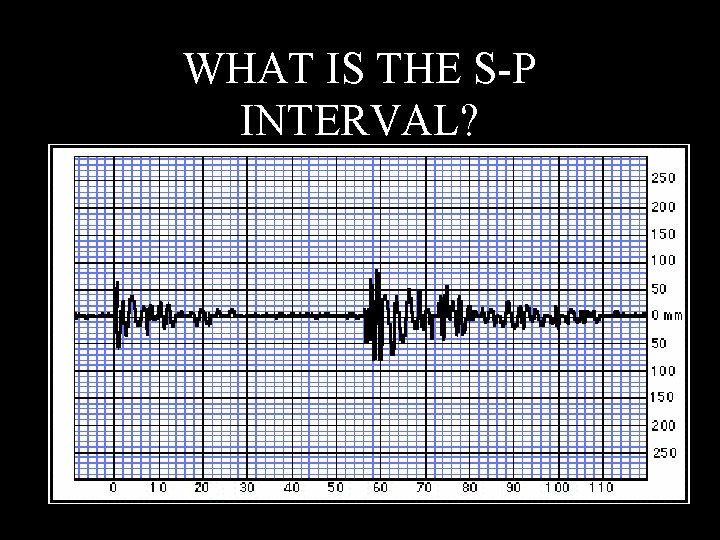 WHAT IS THE S-P INTERVAL? 