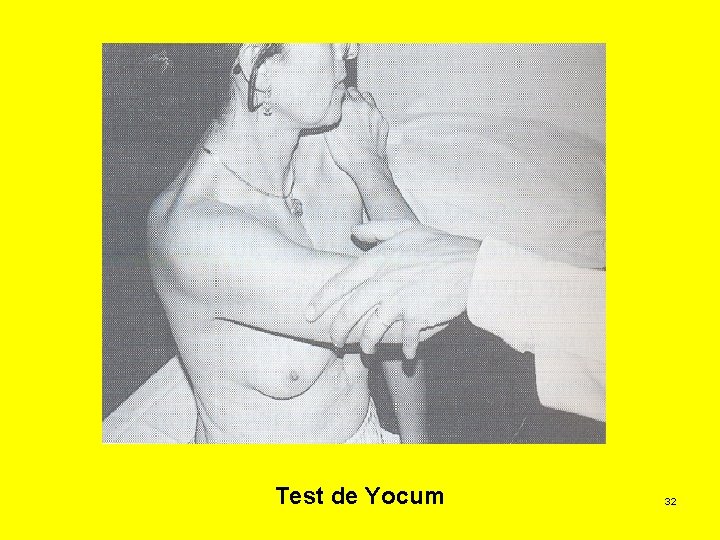 Test de Yocum 32 