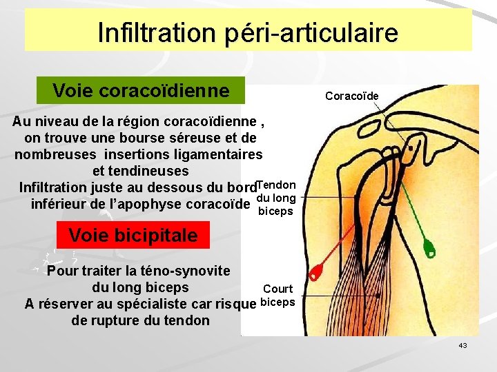 Infiltration péri-articulaire Voie coracoïdienne Coracoïde Au niveau de la région coracoïdienne , on trouve