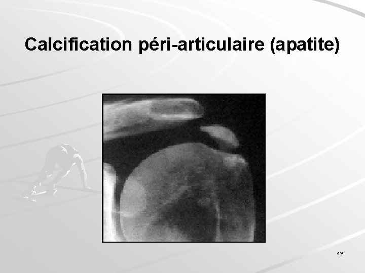Calcification péri-articulaire (apatite) 49 