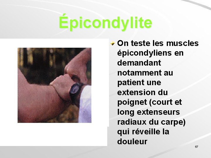 Épicondylite On teste les muscles épicondyliens en demandant notamment au patient une extension du
