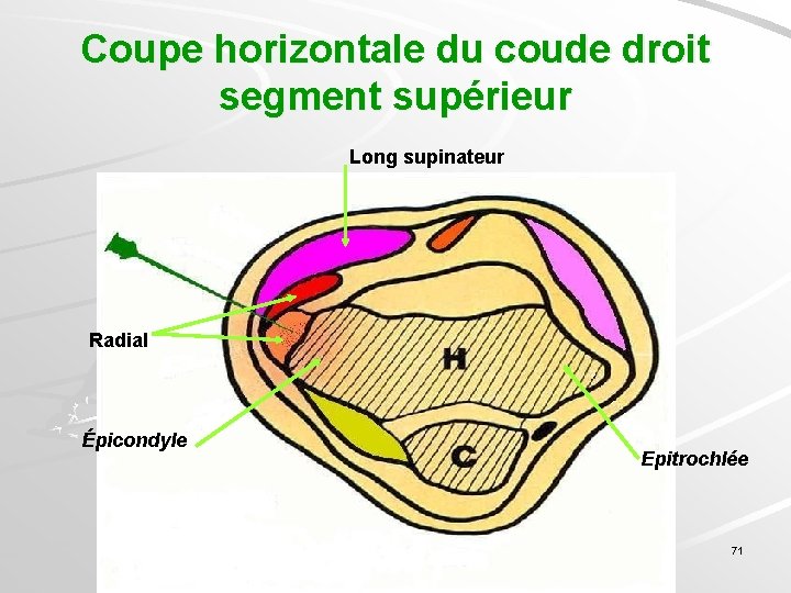 Coupe horizontale du coude droit segment supérieur Long supinateur Radial Épicondyle Epitrochlée 71 