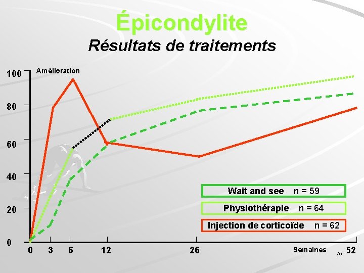 Épicondylite Résultats de traitements 100 Amélioration 80 60 40 Wait and see 20 Physiothérapie