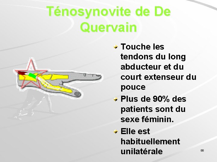 Ténosynovite de De Quervain Touche les tendons du long abducteur et du court extenseur