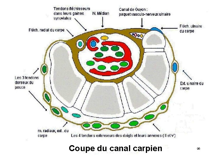 Coupe du canal carpien 96 
