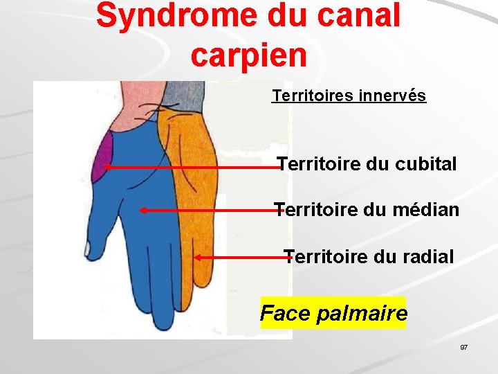 Syndrome du canal carpien Territoires innervés Territoire du cubital Territoire du médian Territoire du