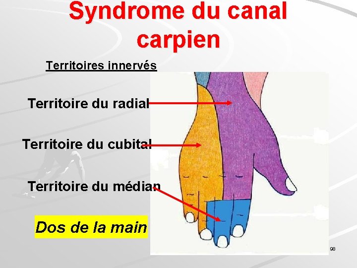 Syndrome du canal carpien Territoires innervés Territoire du radial Territoire du cubital Territoire du