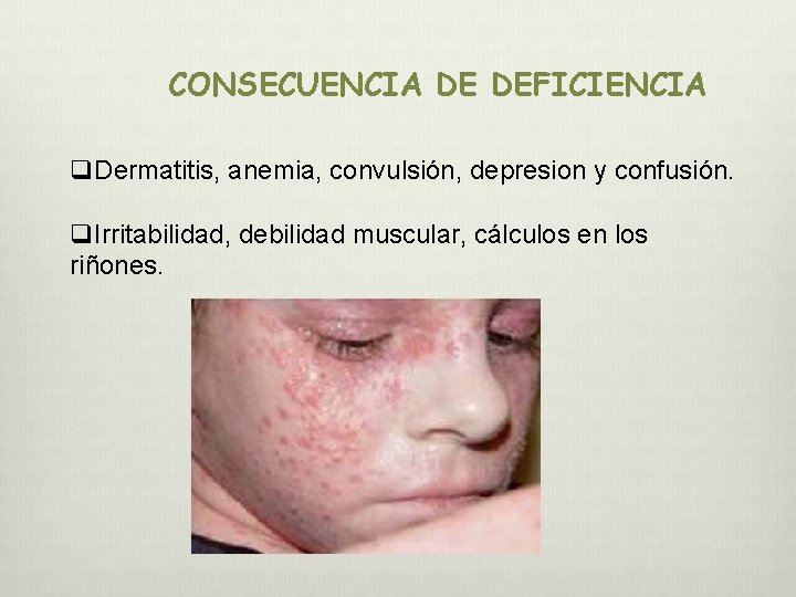 CONSECUENCIA DE DEFICIENCIA q. Dermatitis, anemia, convulsión, depresion y confusión. q. Irritabilidad, debilidad muscular, CONSECUENCIA DE DEFICIENCIA q. Dermatitis, anemia, convulsión, depresion y confusión. q. Irritabilidad, debilidad muscular,