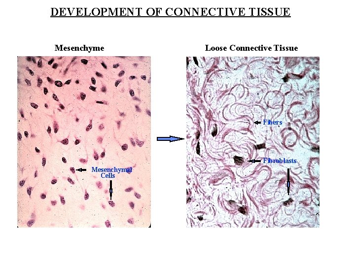 DEVELOPMENT OF CONNECTIVE TISSUE Mesenchyme Loose Connective Tissue Fibers Fibroblasts Mesenchymal Cells 