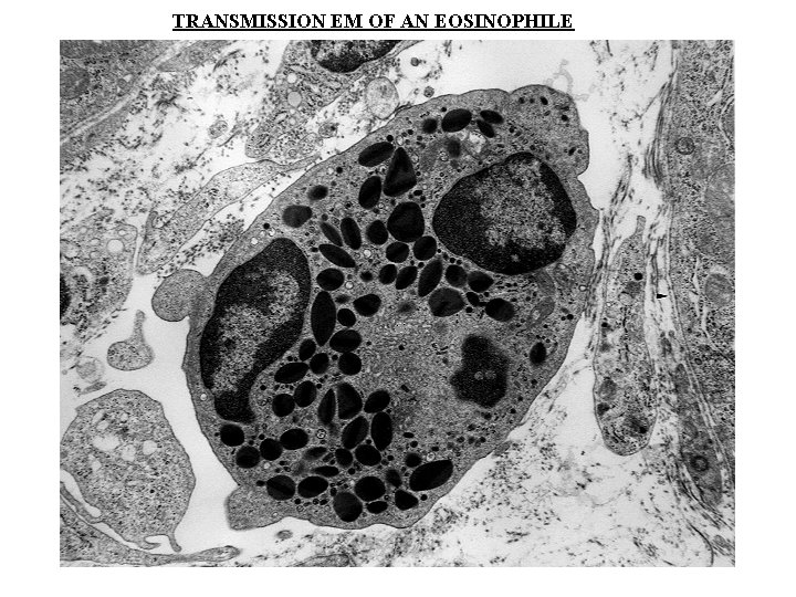 TRANSMISSION EM OF AN EOSINOPHILE 