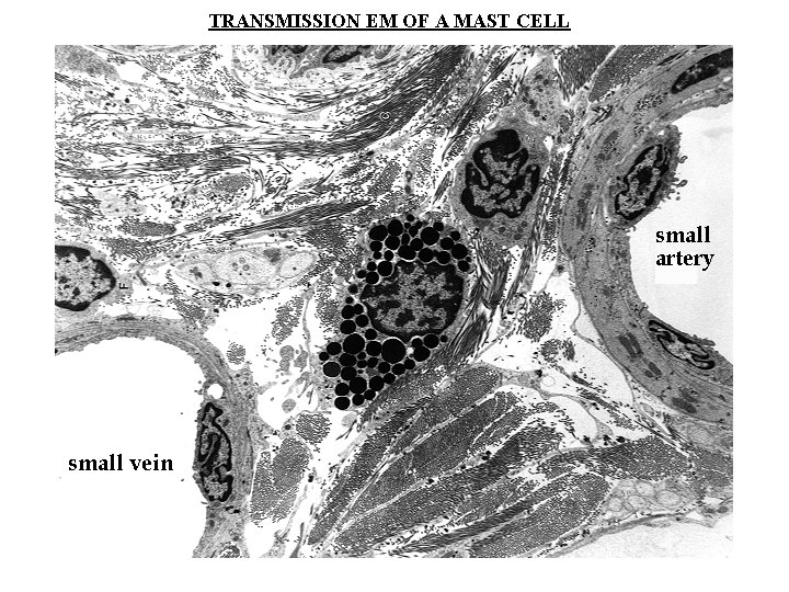 TRANSMISSION EM OF A MAST CELL 