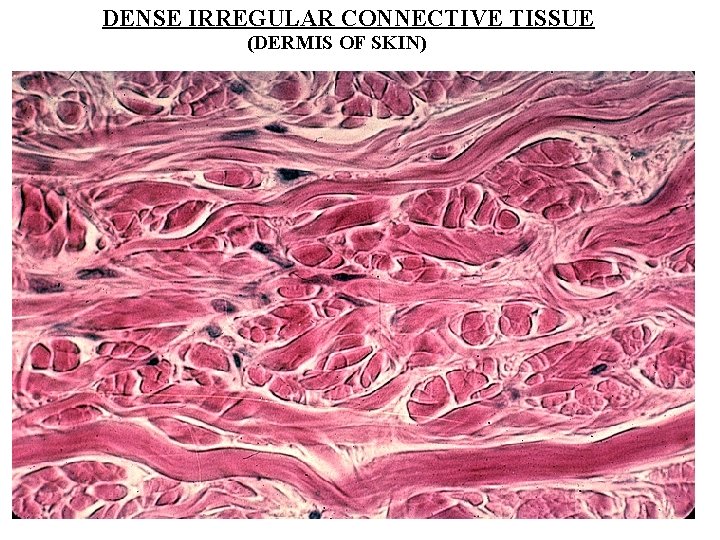 DENSE IRREGULAR CONNECTIVE TISSUE (DERMIS OF SKIN) 