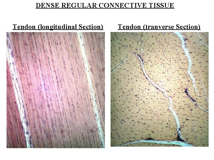 DENSE REGULAR CONNECTIVE TISSUE Tendon (longitudinal Section) Tendon (tranverse Section) 