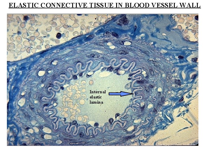 ELASTIC CONNECTIVE TISSUE IN BLOOD VESSEL WALL Internal elastic lamina 