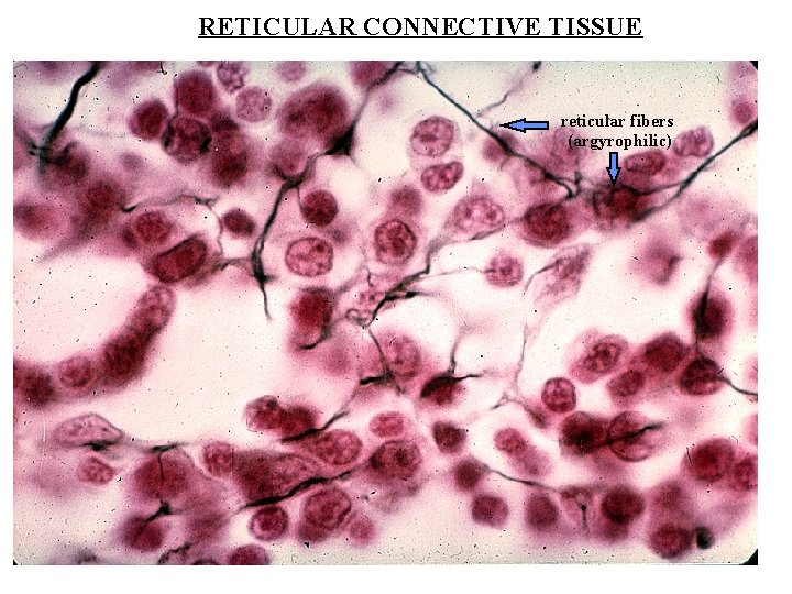 RETICULAR CONNECTIVE TISSUE reticular fibers (argyrophilic) 