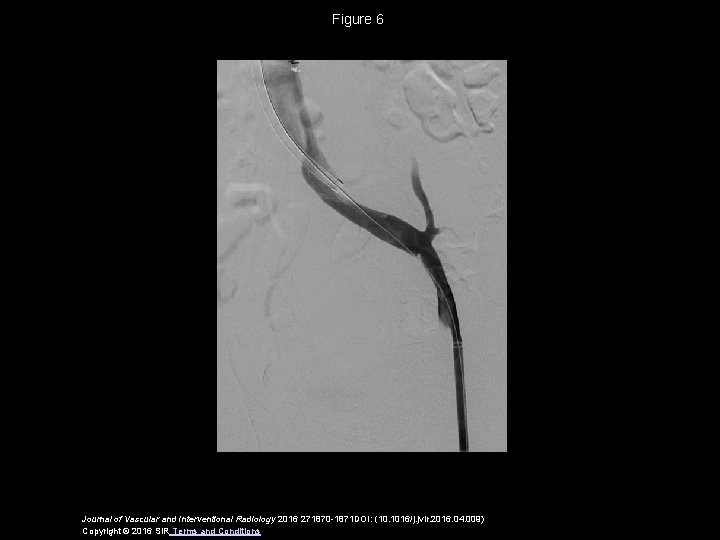 Figure 6 Journal of Vascular and Interventional Radiology 2016 271870 -1871 DOI: (10. 1016/j.