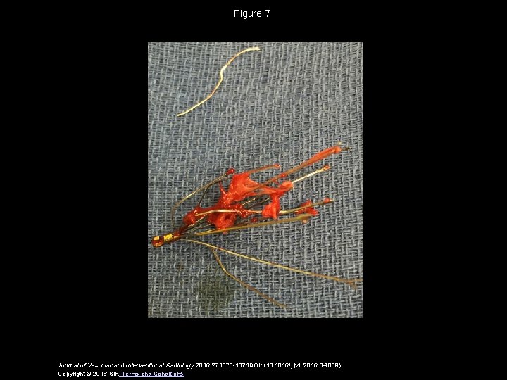 Figure 7 Journal of Vascular and Interventional Radiology 2016 271870 -1871 DOI: (10. 1016/j.