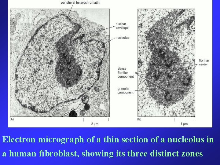 Electron micrograph of a thin section of a nucleolus in a human fibroblast, showing