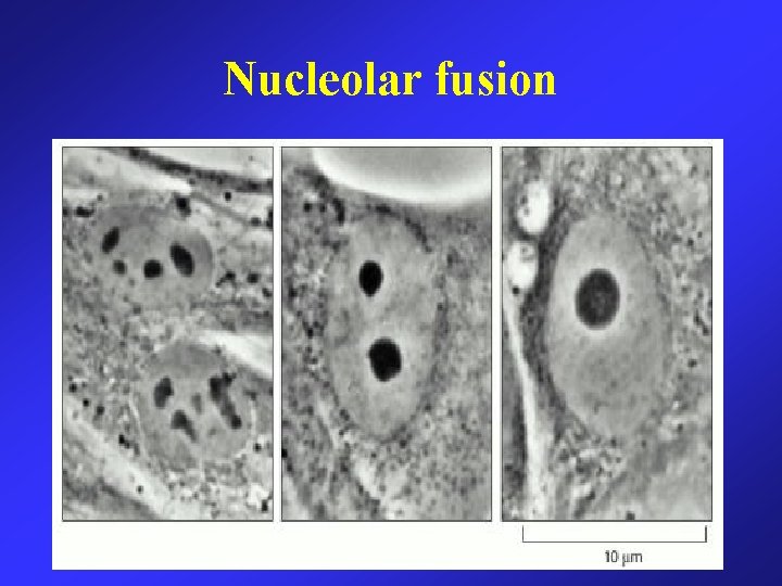 Nucleolar fusion 