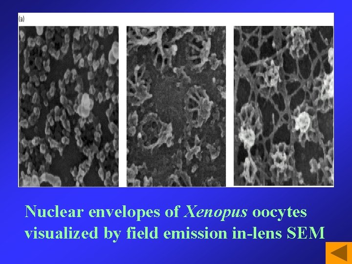 Nuclear envelopes of Xenopus oocytes visualized by field emission in-lens SEM 