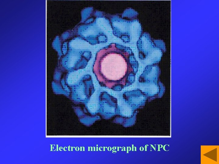 Electron micrograph of NPC 