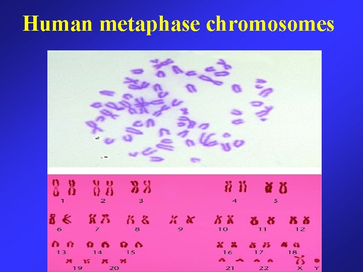 Human metaphase chromosomes 