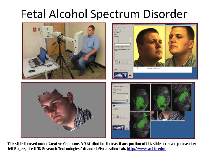 Fetal Alcohol Spectrum Disorder This slide licensed under Creative Commons 3. 0 Attribution license.