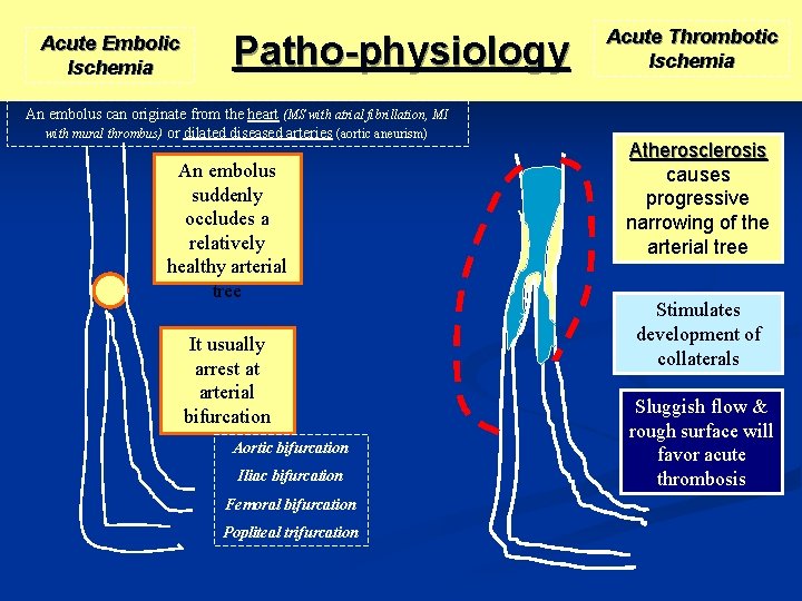 Acute Embolic Ischemia Patho-physiology An embolus can originate from the heart (MS with atrial