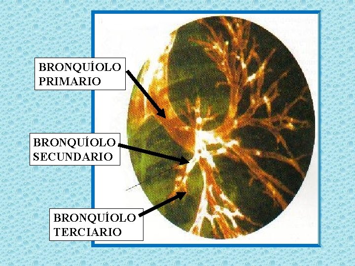 BRONQUÍOLO PRIMARIO BRONQUÍOLO SECUNDARIO BRONQUÍOLO TERCIARIO 