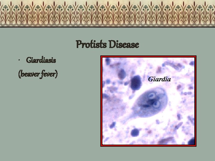 Protists Disease • Giardiasis (beaver fever) Giardia 