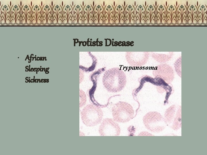 Protists Disease • African Sleeping Sickness Trypanosoma 