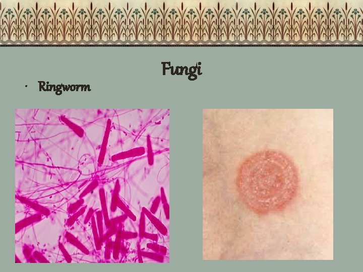  • Ringworm Fungi 