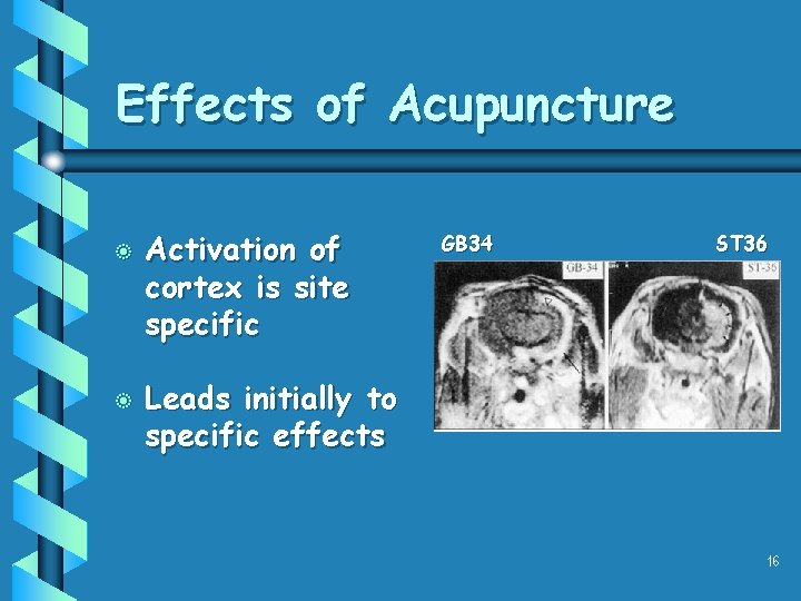 Effects of Acupuncture b b Activation of cortex is site specific GB 34 ST