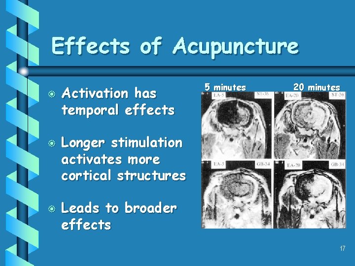 Effects of Acupuncture b b b Activation has temporal effects 5 minutes 20 minutes