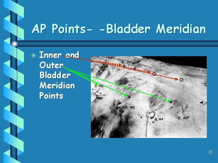 AP Points- -Bladder Meridian b Inner and Outer Bladder Meridian Points 25 