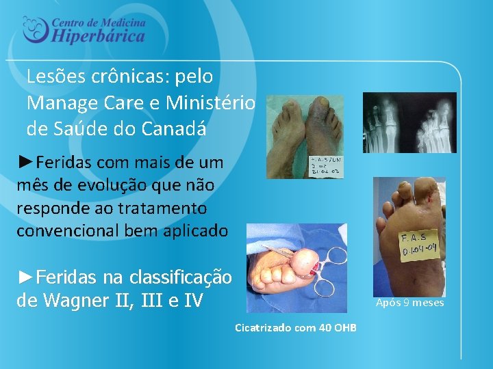 Lesões crônicas: pelo Manage Care e Ministério de Saúde do Canadá ►Feridas com mais