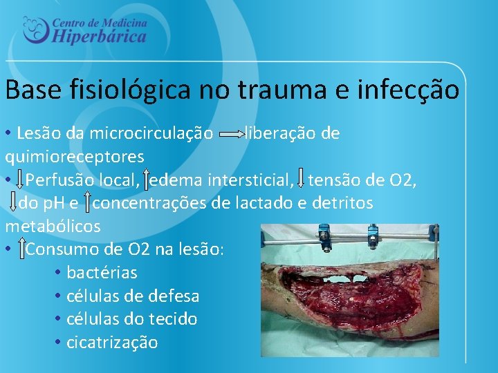 Base fisiológica no trauma e infecção • Lesão da microcirculação liberação de quimioreceptores •
