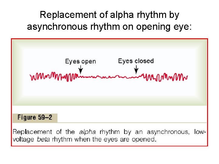 Replacement of alpha rhythm by asynchronous rhythm on opening eye: 